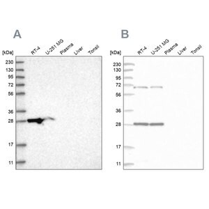 Merck Anti-MRPL10 antibody produced in rabbit