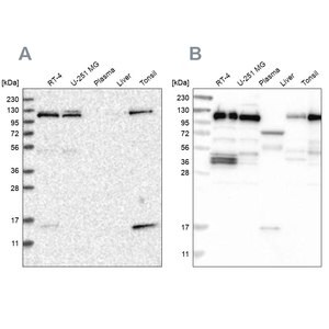 Merck Anti-RABEP1 antibody produced in rabbit