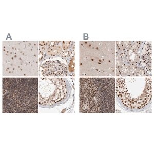 Merck Anti-ZNF830 antibody produced in rabbit