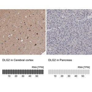 Merck Anti-DLG2 antibody produced in rabbit