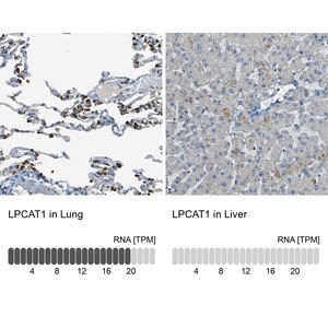 Merck Anti-LPCAT1 antibody produced in rabbit