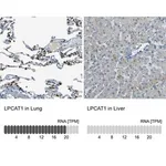 Merck Anti-LPCAT1 antibody produced in rabbit
