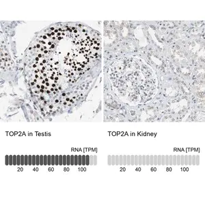 Merck Anti-TOP2A antibody produced in rabbit