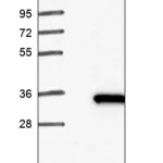 Merck Anti-HSD17B14 antibody produced in rabbit