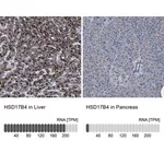 Merck Anti-HSD17B4 antibody produced in rabbit