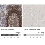 Merck Anti-PRKD2 antibody produced in rabbit