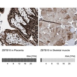 Merck Anti-ZBTB10 antibody produced in rabbit