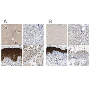 Merck Anti-SERPINB5 antibody produced in rabbit