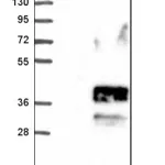 Merck Anti-SLC10A2 antibody produced in rabbit