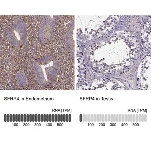 Merck Anti-SFRP4 antibody produced in rabbit