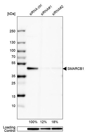 Merck Anti-SMARCB1 antibody produced in rabbit