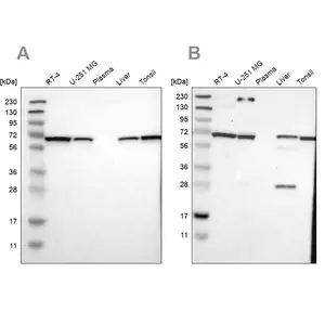 Merck Anti-LTA4H antibody produced in rabbit