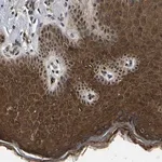 Merck Anti-TRIM35 antibody produced in rabbit