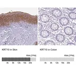 Merck Anti-KRT10 antibody produced in rabbit