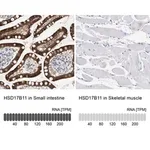 Merck Anti-HSD17B11 antibody produced in rabbit