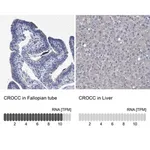 Merck Anti-CROCC antibody produced in rabbit