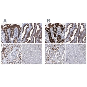 Merck Anti-MKS1 antibody produced in rabbit