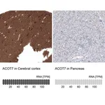 Merck Anti-ACOT7 antibody produced in rabbit