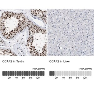 Merck Anti-CCAR2 antibody produced in rabbit