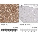 Merck Anti-ACAT2 antibody produced in rabbit