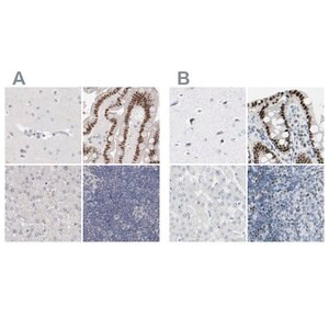 Merck Anti-ZBTB7B antibody produced in rabbit