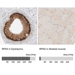 Merck Anti-RPN2 antibody produced in rabbit