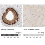 Merck Anti-RPN2 antibody produced in rabbit