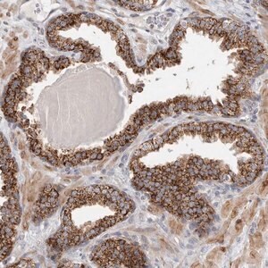 Merck Anti-RAB18 antibody produced in rabbit