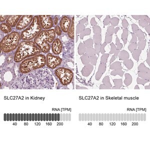 Merck Anti-SLC27A2 antibody produced in rabbit