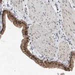 Merck Anti-MKNK2 antibody produced in rabbit