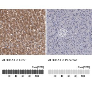 Merck Anti-ALDH8A1 antibody produced in rabbit