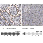 Merck Anti-AKAP9 antibody produced in rabbit