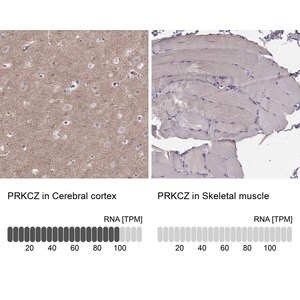 Merck Anti-PRKCZ antibody produced in rabbit