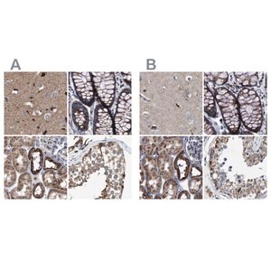 Merck Anti-MECR antibody produced in rabbit