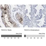 Merck Anti-TACC3 antibody produced in rabbit
