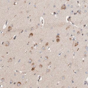 Merck Anti-LZTS1 antibody produced in rabbit