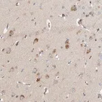 Merck Anti-LZTS1 antibody produced in rabbit