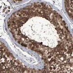 Merck Anti-SPAG5 antibody produced in rabbit