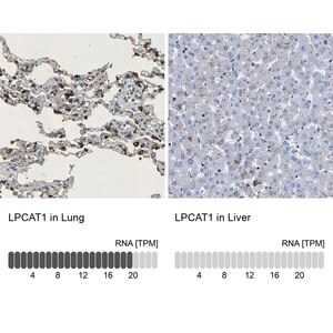 Merck Anti-LPCAT1 antibody produced in rabbit
