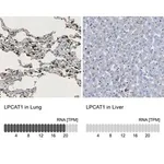 Merck Anti-LPCAT1 antibody produced in rabbit