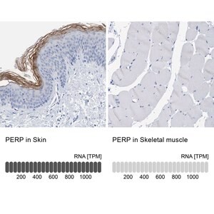 Merck Anti-PERP antibody produced in rabbit