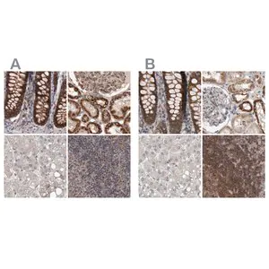 Merck Anti-DARS2 antibody produced in rabbit