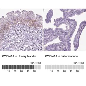Merck Anti-CYP24A1 antibody produced in rabbit
