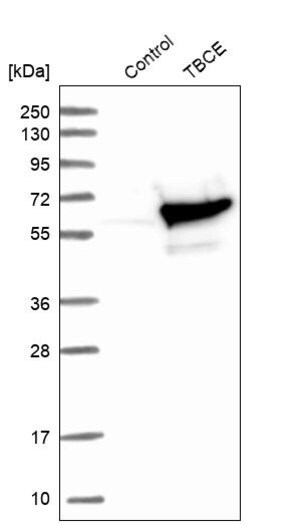 Merck Anti-TBCE antibody produced in rabbit