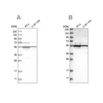 Merck Anti-DDX6 antibody produced in rabbit