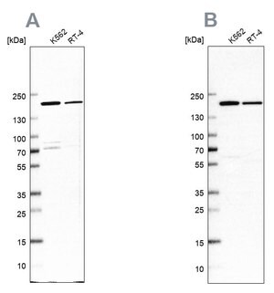 Merck Anti-EPRS antibody produced in rabbit