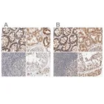 Merck Anti-MRM3 antibody produced in rabbit