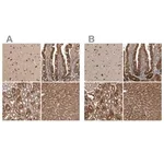 Merck Anti-TRMT61B antibody produced in rabbit