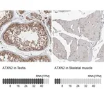 Merck Anti-ATXN2 antibody produced in rabbit