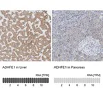 Merck Anti-ADHFE1 antibody produced in rabbit